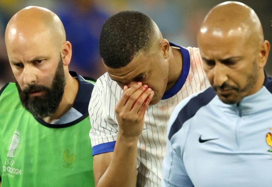 Mbappé se fracturó el caballete pero no será operado