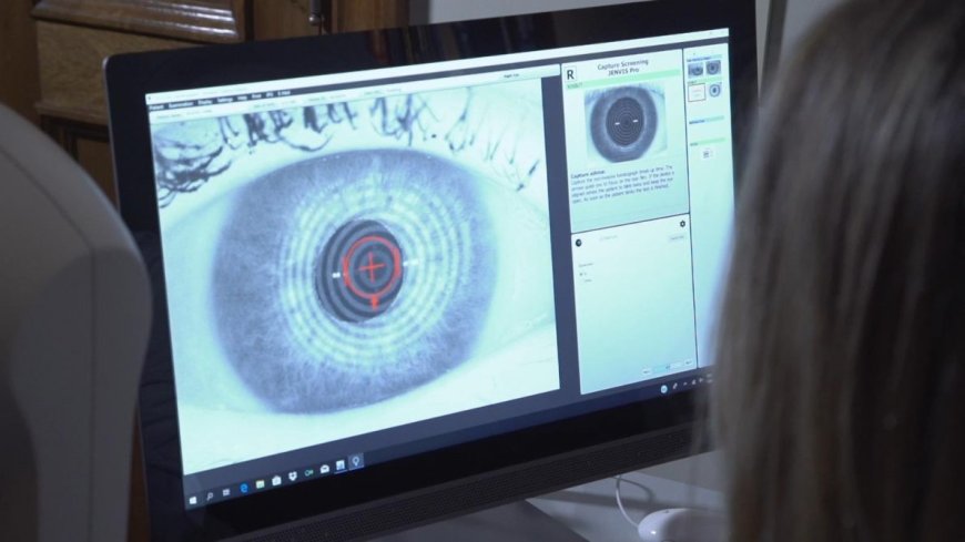 Preocupa a los oftalmólogos el crecimiento del síndrome de ojo seco en Uruguay